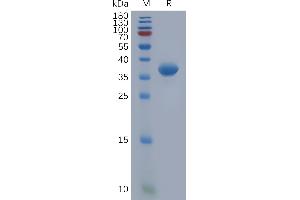 Human C Protein, hFc Tag on SDS-PAGE under reducing condition. (CXCL1 Protein (Fc Tag))