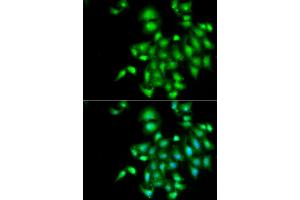 Immunofluorescence analysis of  cells using IL20 antibody (ABIN6128133, ABIN6142353, ABIN6142354 and ABIN6222322). (IL-20 antibody  (AA 25-176))