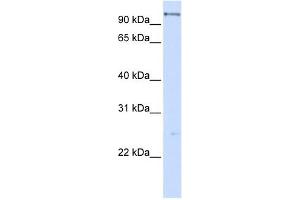 DHX15 antibody used at 1 ug/ml to detect target protein. (DHX15 antibody)