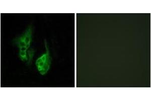 Immunofluorescence analysis of HeLa cells, using OPN5 Antibody. (OPN5 antibody  (AA 251-300))