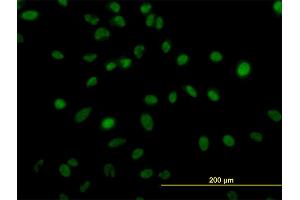 Immunofluorescence of monoclonal antibody to ZNF207 on HeLa cell. (ZNF207 antibody  (AA 1-110))
