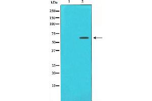 Western blot analysis of Estrogen Receptor-alpha expression in 293 whole cell lysates,The lane on the left is treated with the antigen-specific peptide. (Estrogen Receptor alpha antibody  (C-Term))