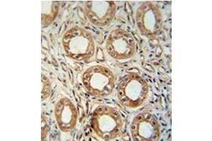 Formalin fixed, paraffin embedded Human kidney tissue stained with LNPEP Antibody (N-Term) followed by peroxidase conjugation of the secondary antibody and DAB staining. (LNPEP antibody  (N-Term))