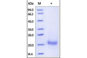 Human TRAIL R1, His Tag on SDS-PAGE under reducing (R) condition. (TNFRSF10A Protein (AA 24-239) (His tag))