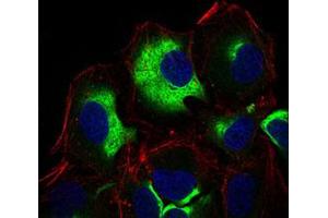 Immunofluorescent staining of HeLa cells using IL3RA monoclonal antibody, clone 10B8E7 . (IL3RA antibody)