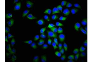 Immunofluorescence (IF) image for anti-Calcium Channel, Voltage-Dependent, L Type, alpha 1C Subunit (CACNA1C) (AA 1755-1971) antibody (ABIN7175586)