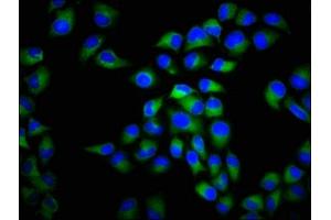 Immunofluorescence staining of Hela cells with ABIN7175586 at 1:266, counter-stained with DAPI. (CACNA1C antibody  (AA 1755-1971))
