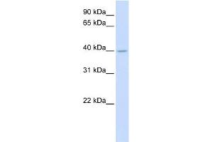 SRD5A3 antibody used at 1 ug/ml to detect target protein.