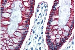 Human Colon (formalin-fixed, paraffin-embedded) stained with CLDN7 antibody ABIN364312 at 10 ug/ml followed by biotinylated anti-mouse IgG secondary antibody ABIN481714, alkaline phosphatase-streptavidin and chromogen. (Claudin 7 antibody  (C-Term))