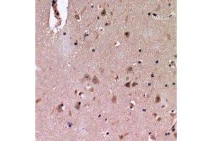 Immunohistochemical analysis of Cadherin 20 staining in human brain formalin fixed paraffin embedded tissue section. (Cadherin 20 antibody)