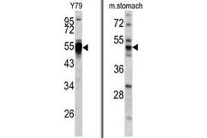 (LEFT) Western blot analysis of PDIA6 antibody (Center K159) in Y79 cell line lysates (35ug/lane). (PDIA6 antibody  (Middle Region))