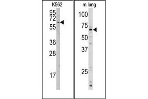 Image no. 1 for anti-Cytochrome P450, Family 1, Subfamily A, Polypeptide 1 (CYP1A1) (AA 384-414), (C-Term) antibody (ABIN360413) (CYP1A1 antibody  (C-Term))
