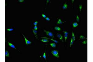 Immunofluorescent analysis of Hela cells using ABIN7154107 at dilution of 1:100 and Alexa Fluor 488-congugated AffiniPure Goat Anti-Rabbit IgG(H+L) (GSTM3 antibody  (AA 1-225))