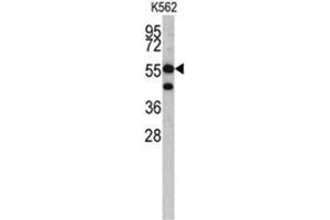 Western blot analysis of HMGCS1 antibody (C-term) in K562 cell line lysates (35ug/lane).