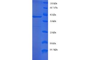 SDS-PAGE (SDS) image for Endosulfine alpha (ENSA) (AA 1-121), (full length) protein (GST tag) (ABIN4975641) (Ensa Protein (AA 1-121, full length) (GST tag))