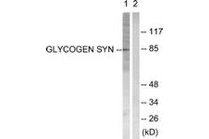 Western blot analysis of extracts from HeLa cells, treated with Serum 20% 30', using Glycogen Synthase (Ab-645) Antibody. (Glycogen Synthase antibody  (AA 621-670))