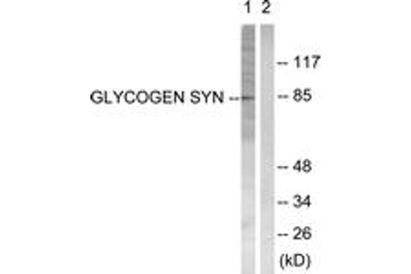 Glycogen Synthase Antikörper  (AA 621-670)