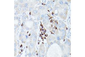Immunohistochemistry (IHC) image for anti-Protein tyrosine Phosphatase, Receptor Type, C (PTPRC) (AA 890-990) antibody (ABIN3022954)