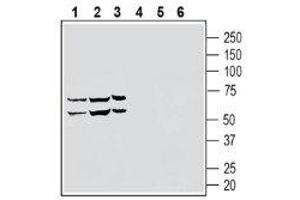 Western blot analysis of human THP-1 monocytic leukemia cell line lysate (lanes 1 and 4), human NK-92 natural killer cell line lysate (lanes 2 and 5) and human HL-60 promyelocytic leukemia cell line lysate (lanes 3 and 6) lysates: - 1-3. (S1PR5 antibody  (Extracellular, N-Term))