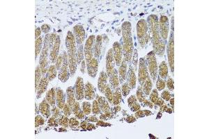 Immunohistochemistry of paraffin-embedded mouse stomach using NTRK1 Antibody (ABIN5971124) at dilution of 1/100 (40x lens). (TRKA antibody)