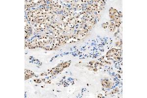 IHC analysis of U1-C/SNRPC using anti-U1-C/SNRPC antibody (ABIN7599016). (SNRPC antibody  (AA 1-159))