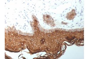 Formalin-fixed, paraffin-embedded human Skin stained with Cytokeratin, 5/6/18 Mouse Monoclonal Antibody (SPM267). (Keratin 5,6,18 antibody)