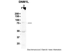 Sample Type: 2. (Dynamin 1-Like antibody  (N-Term))