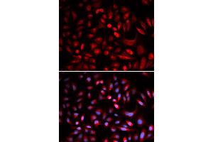 Immunofluorescence analysis of U2OS cells using PRKACB antibody. (PRKACB antibody)