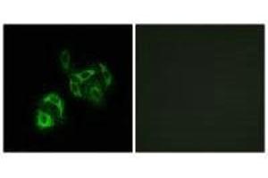 Immunofluorescence analysis of A549 cells, using SLC27A4 antibody. (SLC27A4 antibody)