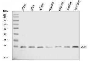 Western blot analysis of Proteasome 20S Beta 7/PSMB7 using anti-Proteasome 20S Beta 7/PSMB7 antibody (ABIN7600256).