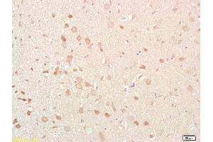 Formalin-fixed and paraffin embedded rat brain labeled with Anti-NKB Polyclonal Antibody, Unconjugated (ABIN724460) at 1:200 followed by conjugation to the secondary antibody and DAB staining (Tachykinin 3 antibody  (AA 81-90))