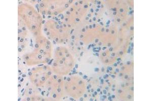 Figure. (MMP13 antibody  (AA 62-217))
