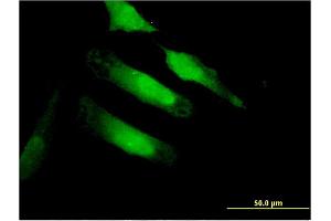 Immunofluorescence of monoclonal antibody to CA10 on HeLa cell. (CA10 antibody  (AA 229-328))