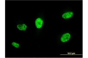 Immunofluorescence of monoclonal antibody to PCGF5 on HeLa cell.