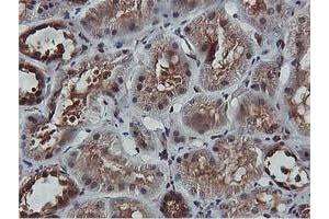 Image no. 4 for anti-V-Akt Murine Thymoma Viral Oncogene Homolog 1 (AKT1) antibody (ABIN1496556) (AKT1 antibody)