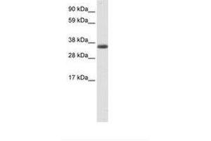 Image no. 1 for anti-Excision Repair Cross-Complementing Rodent Repair Deficiency, Complementation Group 8 (ERCC8) (AA 37-86) antibody (ABIN6736089) (ERCC8 antibody  (AA 37-86))
