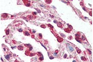 Human Lung (formalin-fixed, paraffin-embedded) stained with CCR3 antibody ABIN461875 at 2. (CCR3 antibody  (N-Term))