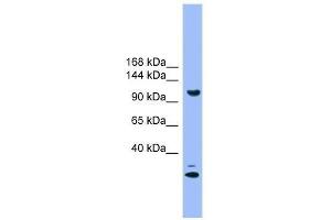 Western Blot showing STARD8 antibody used at a concentration of 1. (STARD8 antibody  (N-Term))