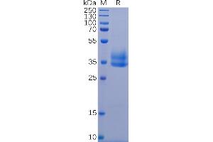 Human IL2RB Protein, His Tag on SDS-PAGE under reducing condition. (IL2 Receptor beta Protein (AA 27-239) (His tag))
