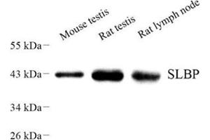 Western blot analysis of SLBP (ABIN7075733) at dilution of 1: 500 (SLBP antibody)
