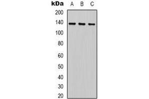 Western blot analysis of HER2 expression in HEK293T (A), 22RV1 (B), Hela (C) whole cell lysates. (ErbB2/Her2 antibody)