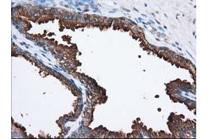 Immunohistochemical staining of paraffin-embedded Human prostate tissue using anti-PANK2 mouse monoclonal antibody.