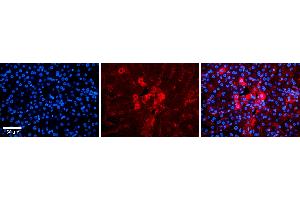 Rabbit Anti-METTL5 Antibody Catalog Number: ARP54982_P050 Formalin Fixed Paraffin Embedded Tissue: Human Liver Tissue Observed Staining: Cytoplasm in hepatocytes and sinusoids Primary Antibody Concentration: 1:100 Other Working Concentrations: 1:600 Secondary Antibody: Donkey anti-Rabbit-Cy3 Secondary Antibody Concentration: 1:200 Magnification: 20X Exposure Time: 0.