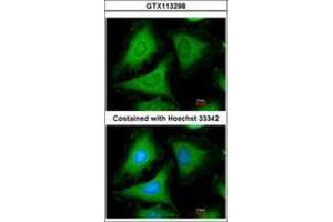 Image no. 2 for anti-14-3-3 gamma (YWHAG1) (AA 1-189) antibody (ABIN467598) (14-3-3 gamma antibody  (AA 1-189))