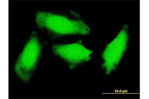 Immunofluorescence of monoclonal antibody to GCH1 on HeLa cell. (GCH1 antibody  (AA 1-250))