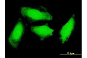 Immunofluorescence of monoclonal antibody to GCH1 on HeLa cell.