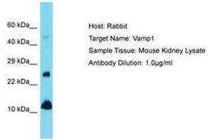 Image no. 1 for anti-Vesicle-Associated Membrane Protein 1 (Synaptobrevin 1) (VAMP1) (N-Term) antibody (ABIN6750496) (VAMP1 antibody  (N-Term))