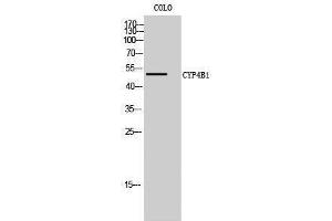 Western Blotting (WB) image for anti-Cytochrome P450, Family 4, Subfamily B, Polypeptide 1 (CYP4B1) (Internal Region) antibody (ABIN3184199) (CYP4B1 antibody  (Internal Region))