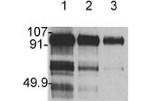 Western blot analysis: Lane 1 hHGF 1 μg, Lane 2 hHGF 0. (HGF antibody)