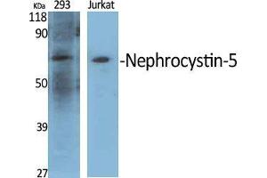 Western Blot (WB) analysis of specific cells using Nephrocystin-5 Polyclonal Antibody. (IQCB1 antibody  (Internal Region))